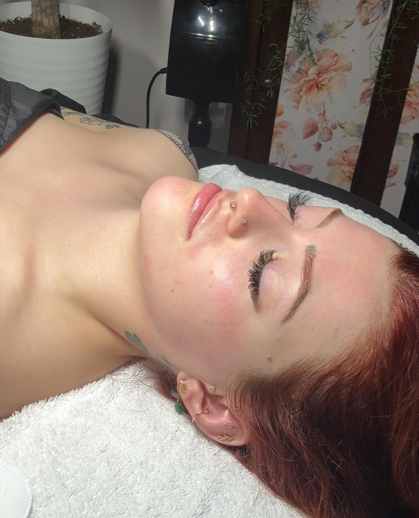 The Importance of Dermaplaning